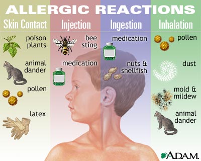 аллергия и лечение